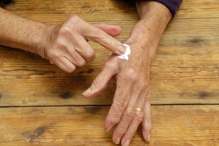Elderly woman putting ointment on her hands