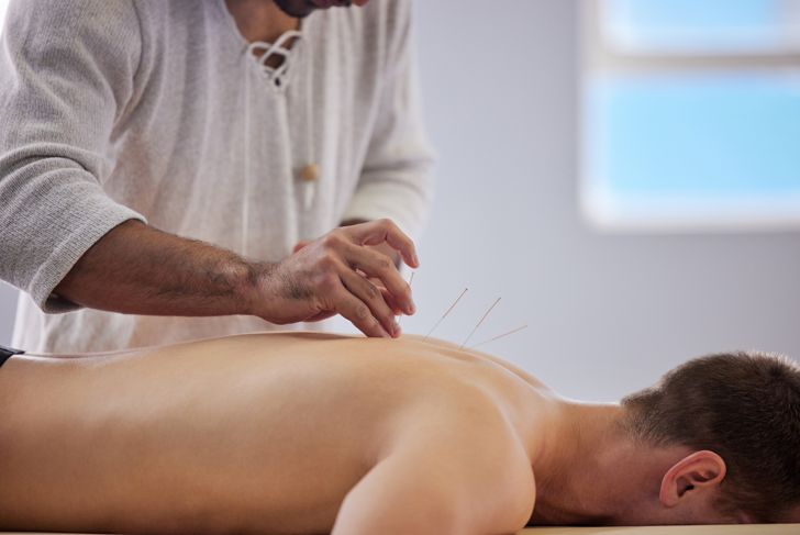 Shot of an acupuncturist treating a client